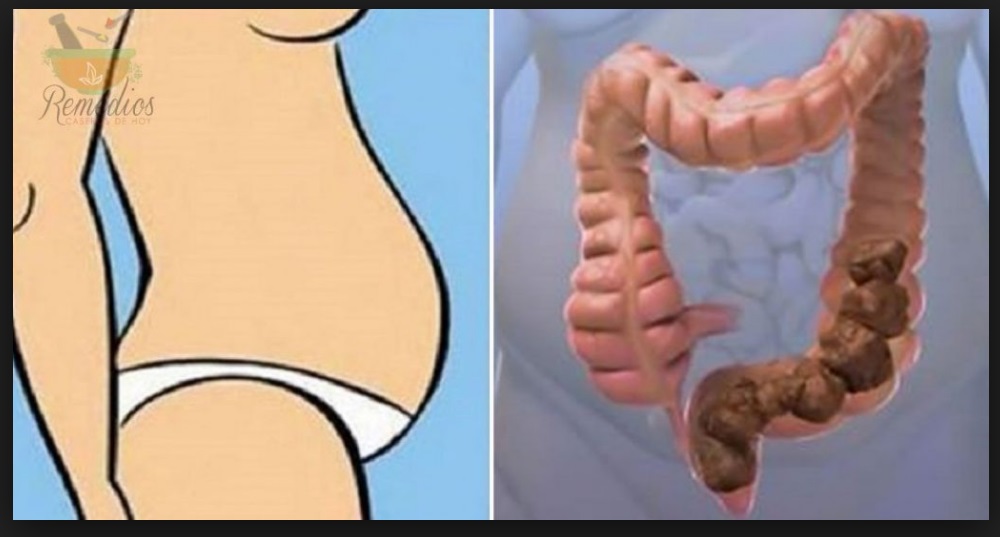 NON SEI GRASSA? FORSE HAI SOLO BISOGNO DI PULIRE ACCURATAMENTE IL COLON