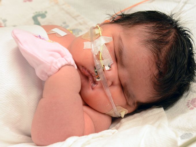 PARTO SHOCK: IL BAMBINO NASCE DI 6KG, ECCO LA REAZIONE DEI MEDICI - FOTO - 06/06/2015