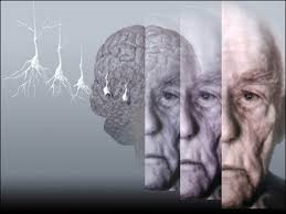 L'INASPETTATA CAUSA DELL'ALZHEIMER - 16/06/2015