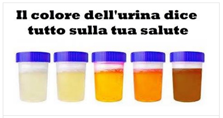 IL COLORE DELLE TUE URINE DICE TUTTO SUL NOSTRO STATO DI SALUTE: ECCO LE DIFFERENZE - 02/08/2017