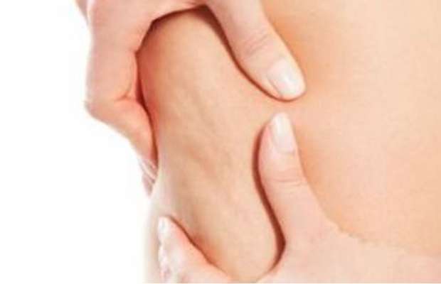 LA SOLUZIONE VELOCE PER FAR SPARIRE LA CELLULITE PRIMA DELL'ESTATE - 13/02/2014