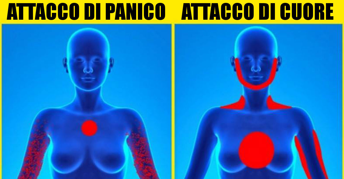 ATTACCO DI CUORE O DI PANICO? ECCO QUALI DIFFERENZE CI PERMETTONO DI DISTINGUERLI - 24/07/2017