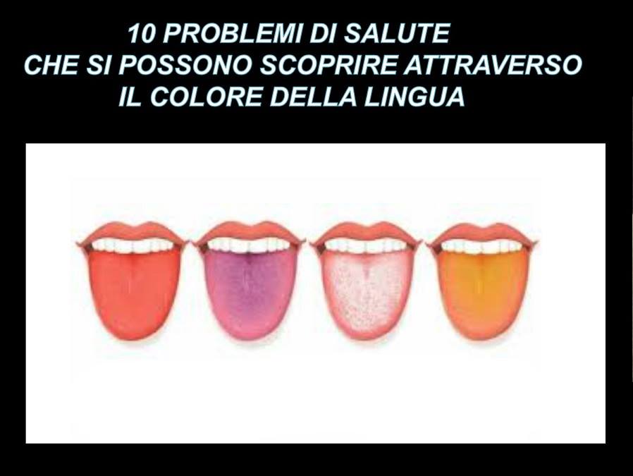 10 PROBLEMI DI SALUTE CHE SI POSSONO SCOPRIRE ATTRAVERSO IL COLORE DELLA LINGUA - 27/11/2017