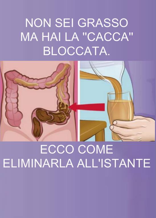 NON SEI GRASSO, MA HAI LA ''CACCA'' BLOCCATA: ECCO COME ELIMINARLA ALL'ISTANTE - 30/10/2017