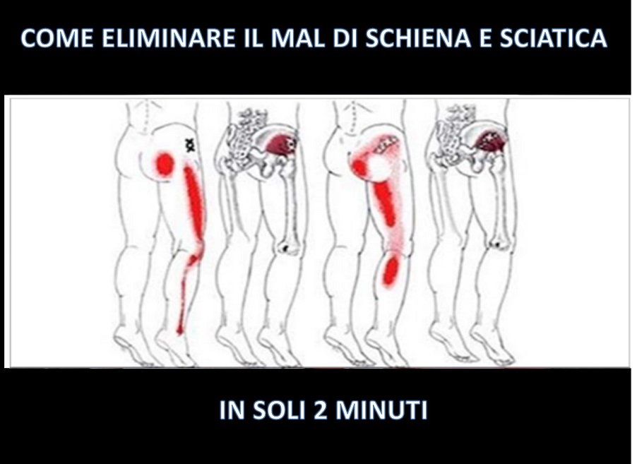 COME ELIMINARE IL MAL DI SCHIENA E SCIATICA IN SOLI 2 MINUTI - 06/11/2017