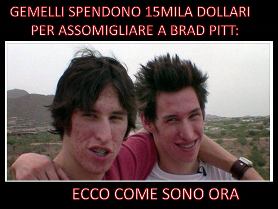 GEMELLI SPENDONO 15MILA DOLLARI PER ASSOMIGLIARE A BRAD PITT: ECCO COME SONO ORA - 04/12/2017