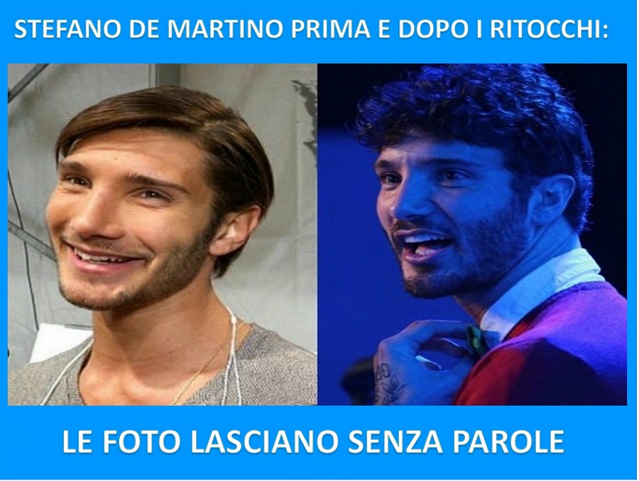 STEFANO DE MARTINO PRIMA E DOPO I RITOCCHI: LE FOTO LASCIANO SENZA PAROLE - 05/12/2017