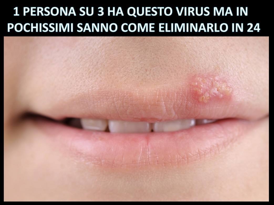 1 PERSONA SU 3 HA QUESTO VIRUS MA IN POCHISSIMI SANNO COME ELIMINARLO IN 24 ORE - 06/12/2017